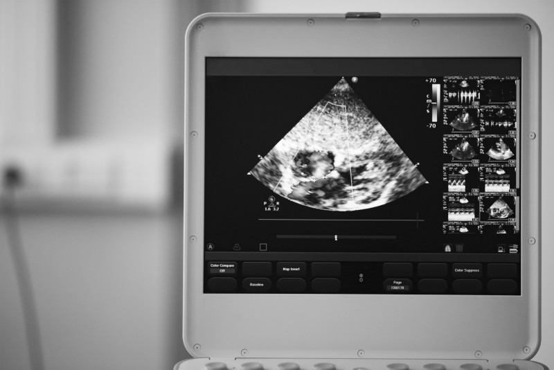 Buying Versus Renting Portable Ultrasound Machines for a Clinic