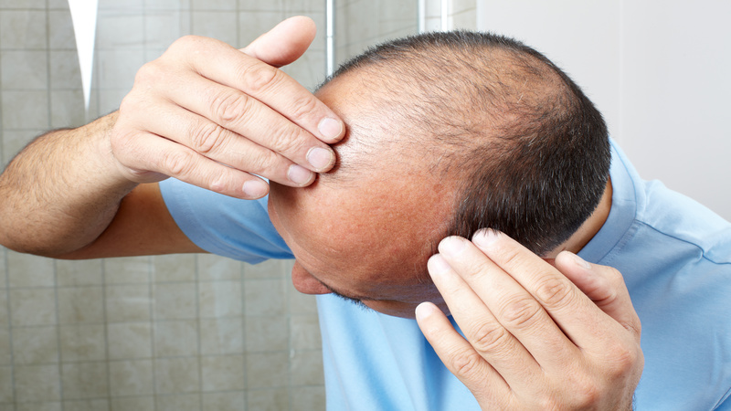 Revive Your Mane: Exploring Innovative Hair Loss Treatments in St. Petersburg, FL